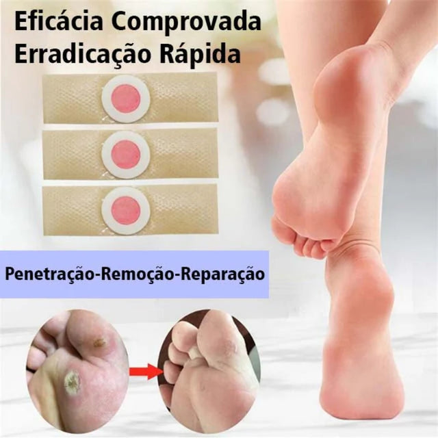 Adesivo Removedor de Calos e Olho de Peixe – Calox | Kaype Store