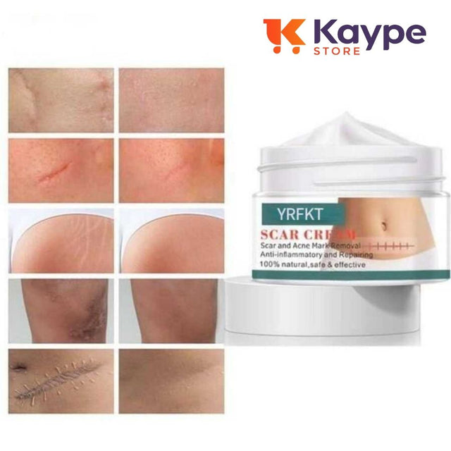 Cica Cream Creme Para Marcas e Cicatriz - Kaype Store