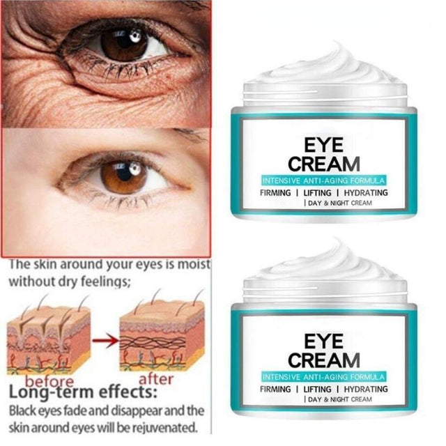 Eye Cream - Acabe com Olheiras, Bolsas e Rugas ao Redor dos Olhos - Kaype Store