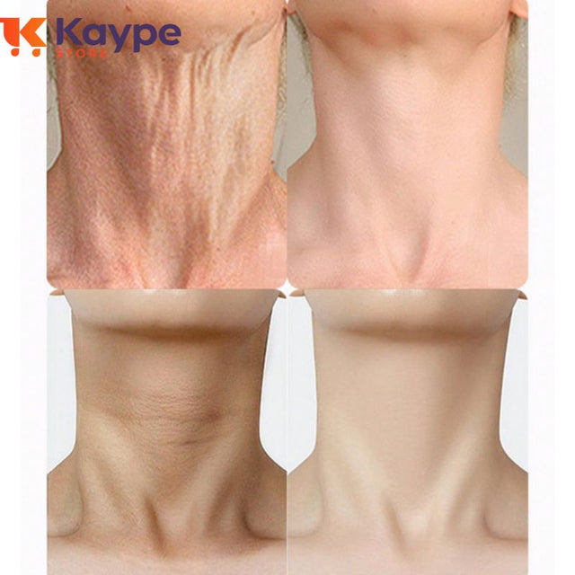 NeckCream - Elimine Rugas e Firme a Pele do Pescoço e Papada - Kaype Store
