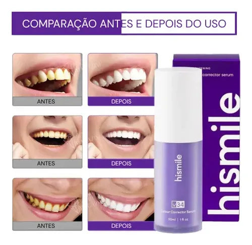 Clareador Dental Sérum V34 – Sorriso Branco Imediato | Kaype Store