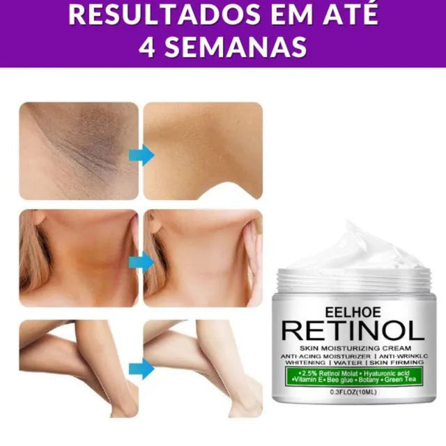 Retinol Original - Creme Clareador Facial, Virilha, Cotovelos e Axilas Kaypestore