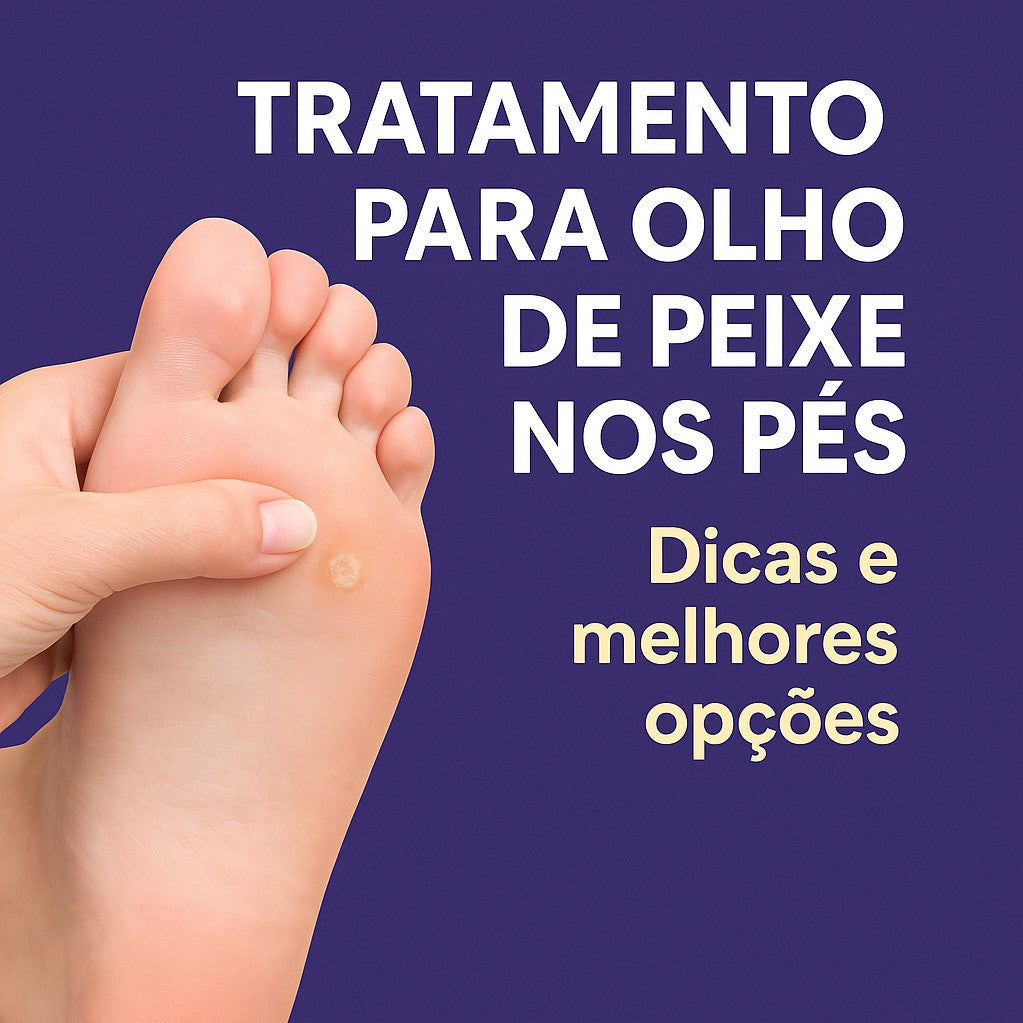Tratamento para Olho de Peixe nos Pés: Dicas e Melhores Opções