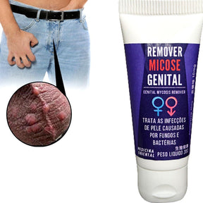 Pomada Antifúngica Íntima Masculina e Feminina - Solução Eficaz para Micoses Genitais - Kaype Store