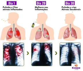 Spray de Limpeza Pulmonar - Herbatox - Kaype Store