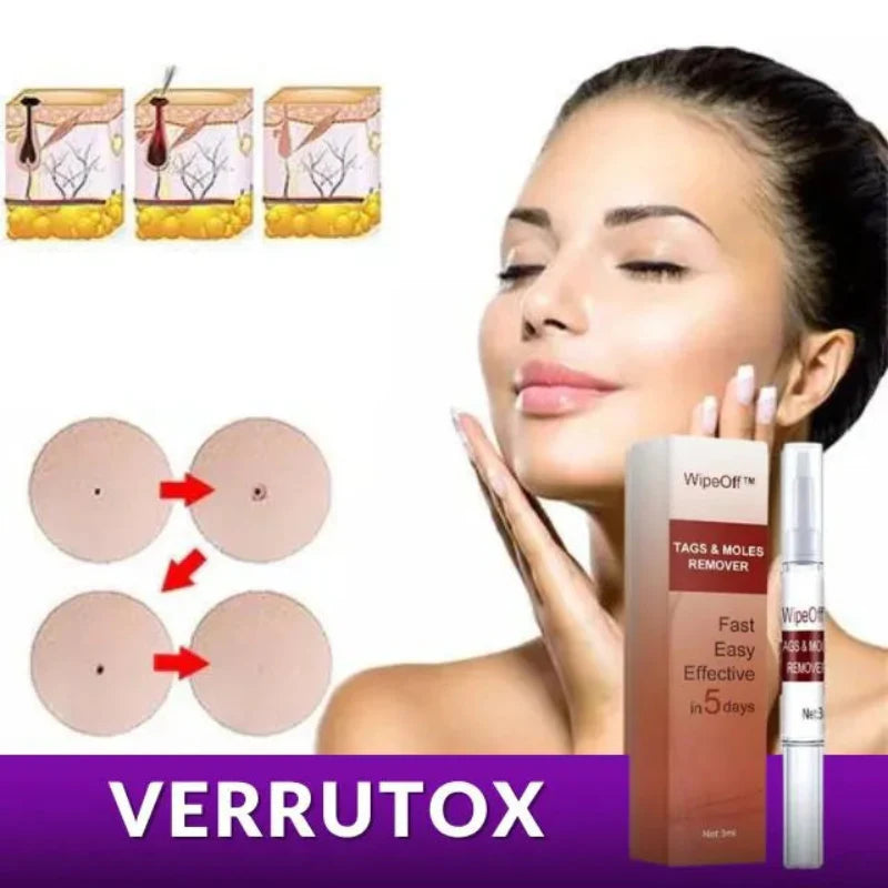 Verrutox - Removedor de Verrugas, Marcas e Manchas | Solução Eficaz e Sem Dor