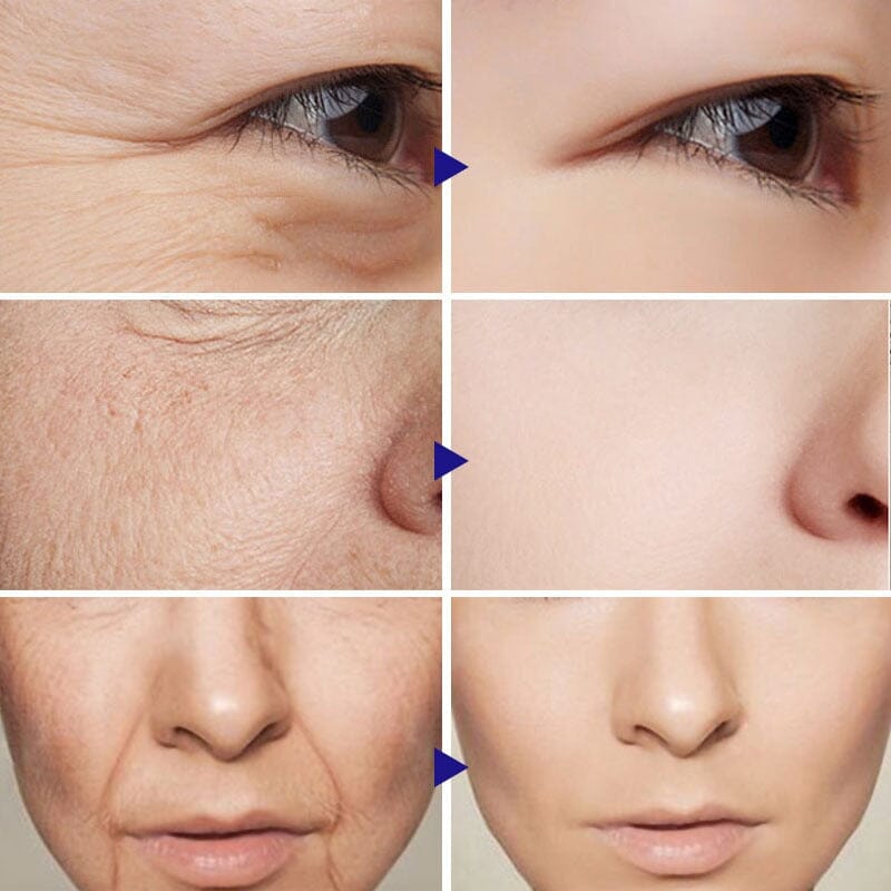 Sérum Retinol Anti-Rugas Combate Linhas De Expressão, olheiras, Flacidez e Viço - Kaype Store